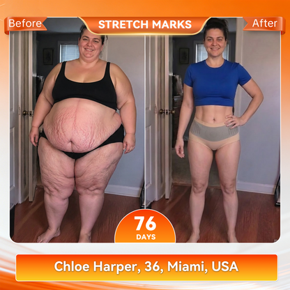 𝐎𝐟𝐟𝐢𝐜𝐢𝐚𝐥 𝐁𝐫𝐚𝐧𝐝 𝐒𝐭𝐨𝐫𝐞 ⚡ 𝐏𝐀𝐔𝐑𝐀𝐉𝐔® 𝟐𝟎𝟐𝟔 𝐌𝐨𝐫𝐢𝐧𝐠𝐚 & 𝐁𝐞𝐫𝐛𝐞𝐫𝐢𝐧𝐞 𝟒-𝐈𝐧-𝟏 𝐌𝐢𝐜𝐫𝐨-𝐏𝐚𝐫𝐭𝐢𝐜𝐥𝐞 𝐒𝐜𝐮𝐥𝐩𝐭𝐢𝐧𝐠 & 𝐅𝐚𝐭-𝐁𝐮𝐫𝐧 𝐒𝐡𝐨𝐫𝐭𝐬